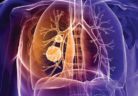 Lung_Cancer_Brochure_Sept_2016_original
