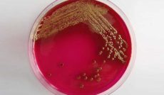 Petri_E-coli_freeimages